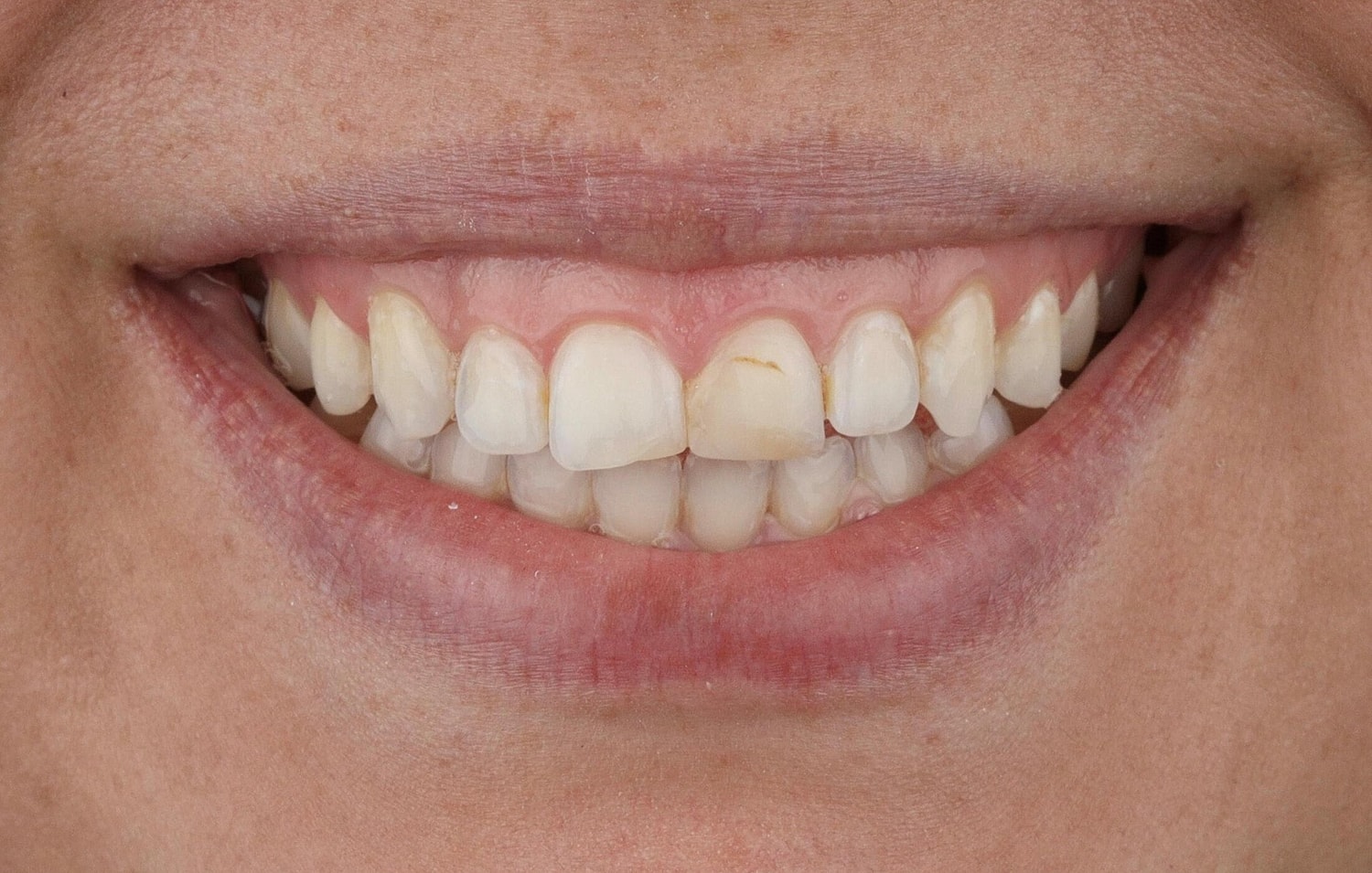Patients Before & After