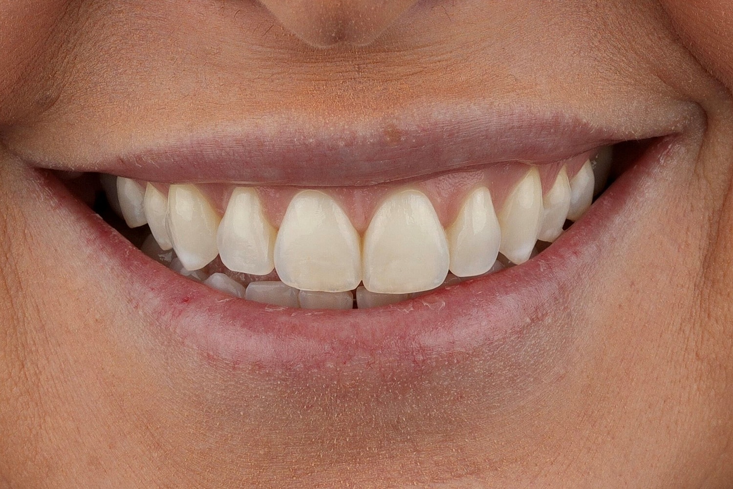 Patients Before & After