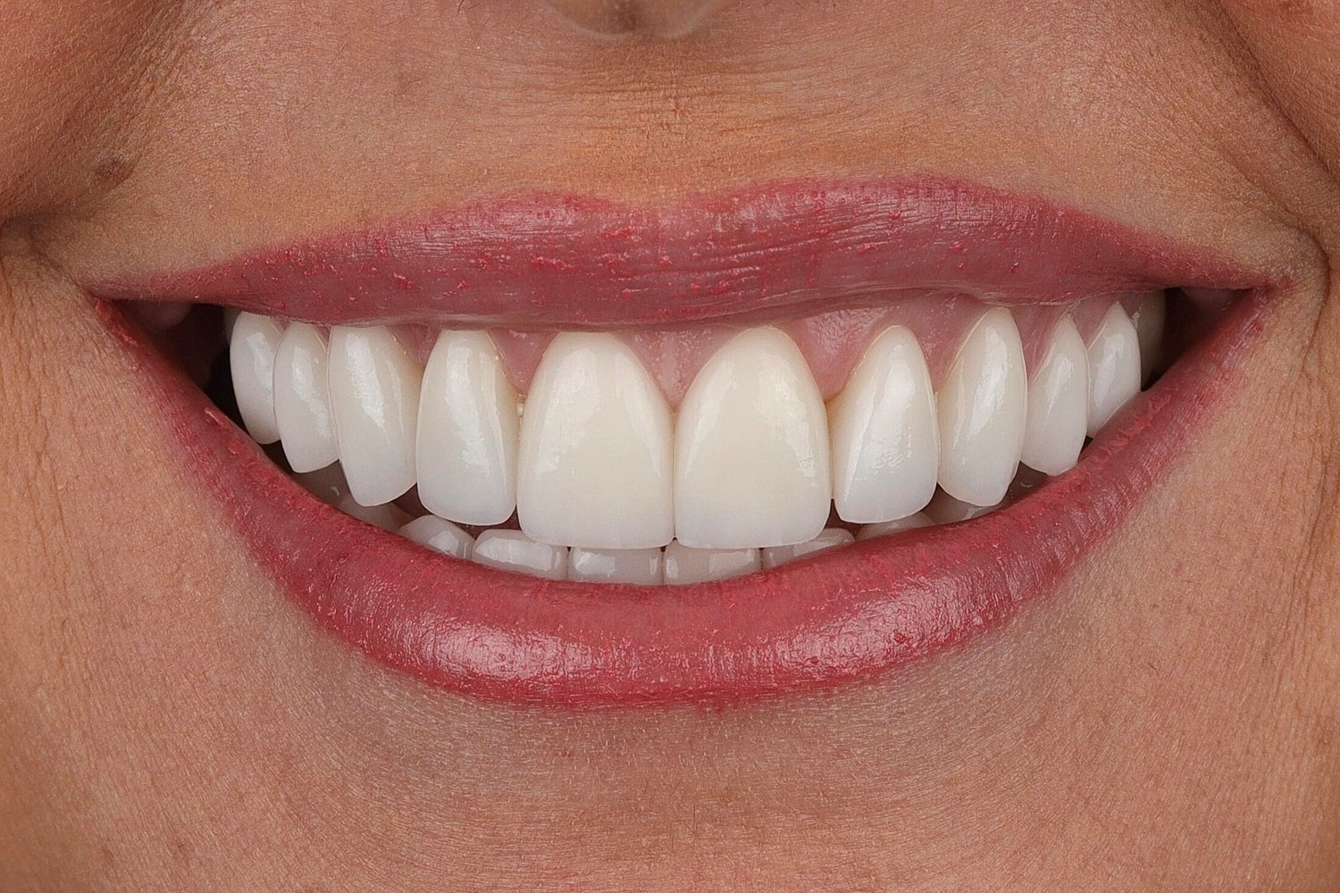 Patients Before & After