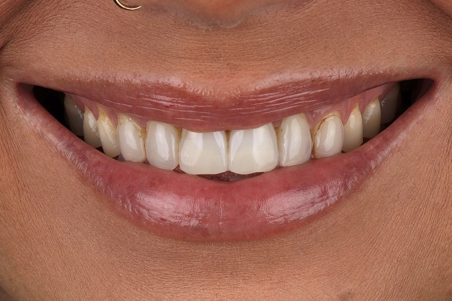 Patients Before & After