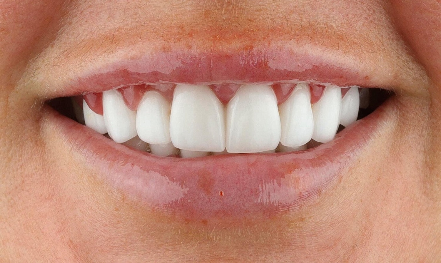 Patients Before & After