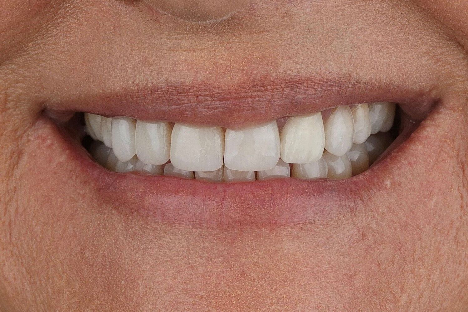 Patients Before & After