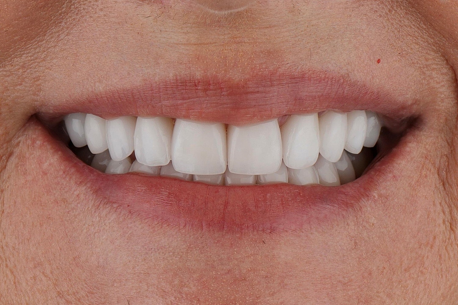 Patients Before & After