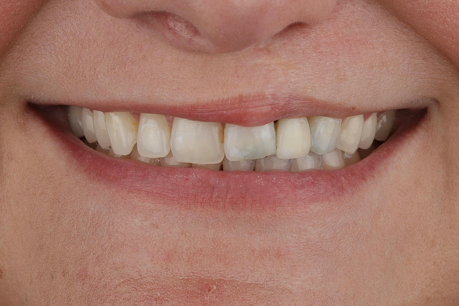 Patients Before & After