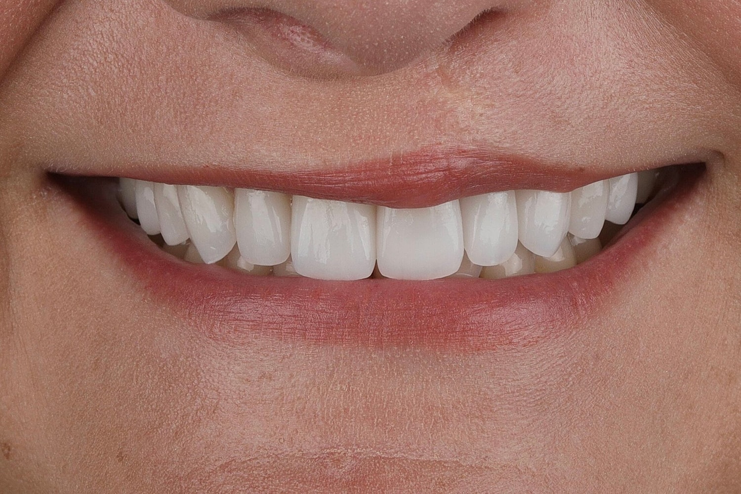Patients Before & After
