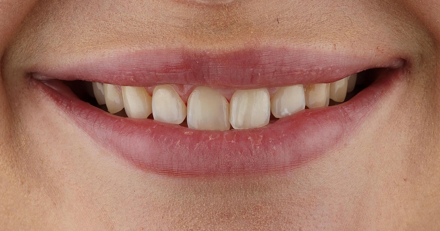 Patients Before & After