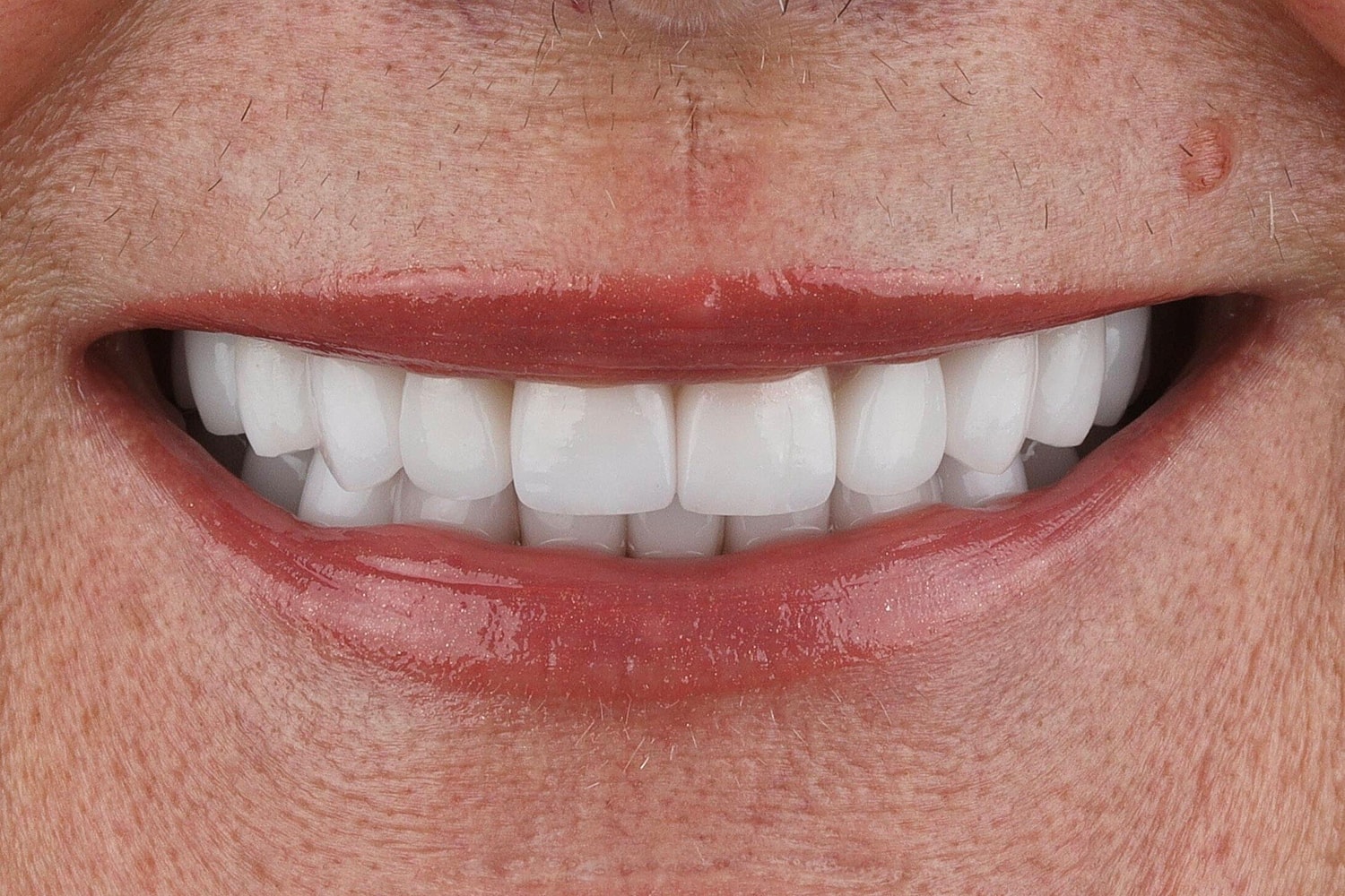 Patients Before & After