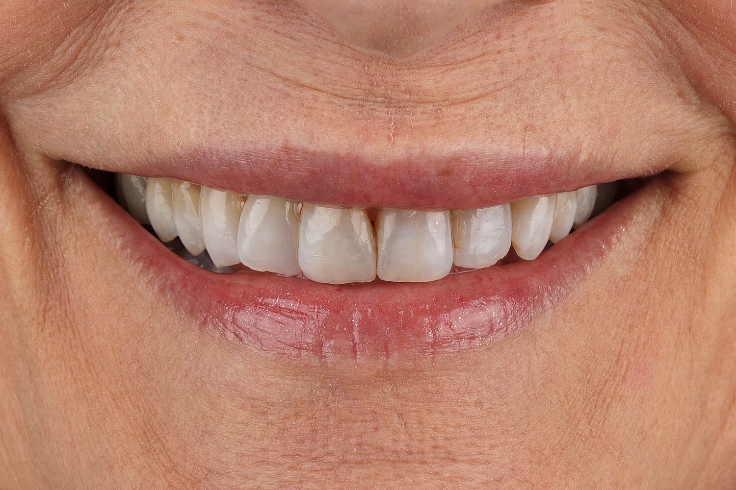 Patients Before & After