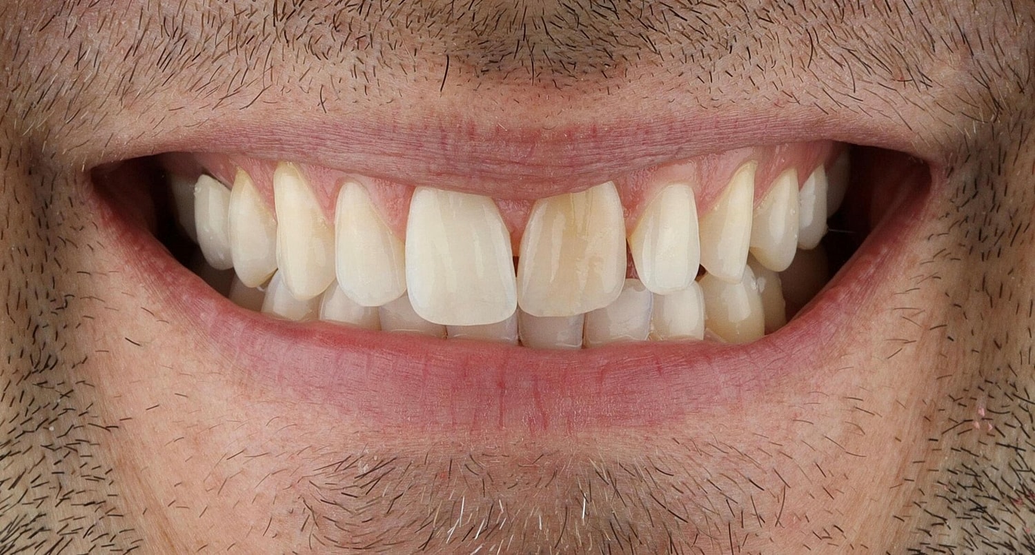 Patients Before & After