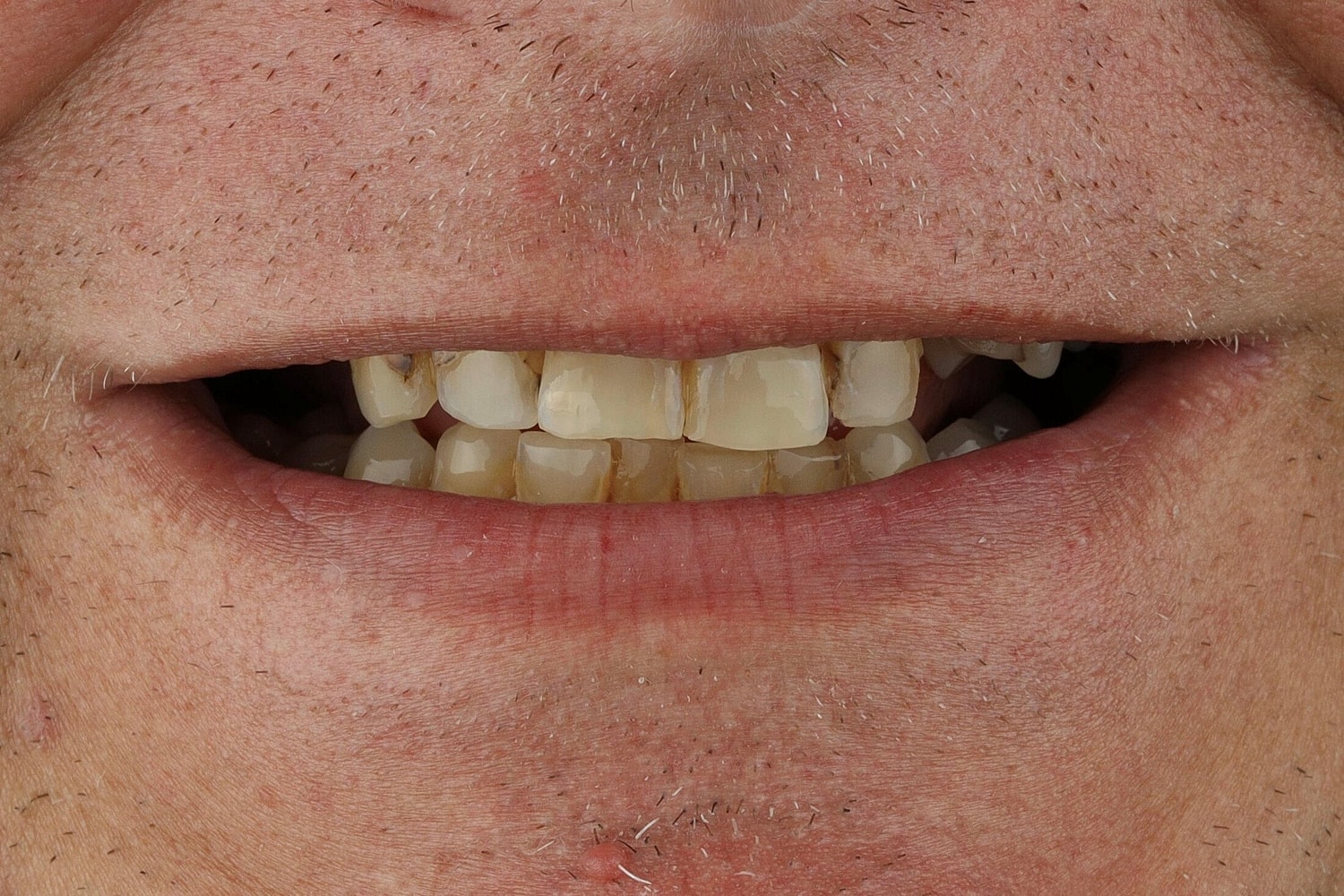 Patients Before & After
