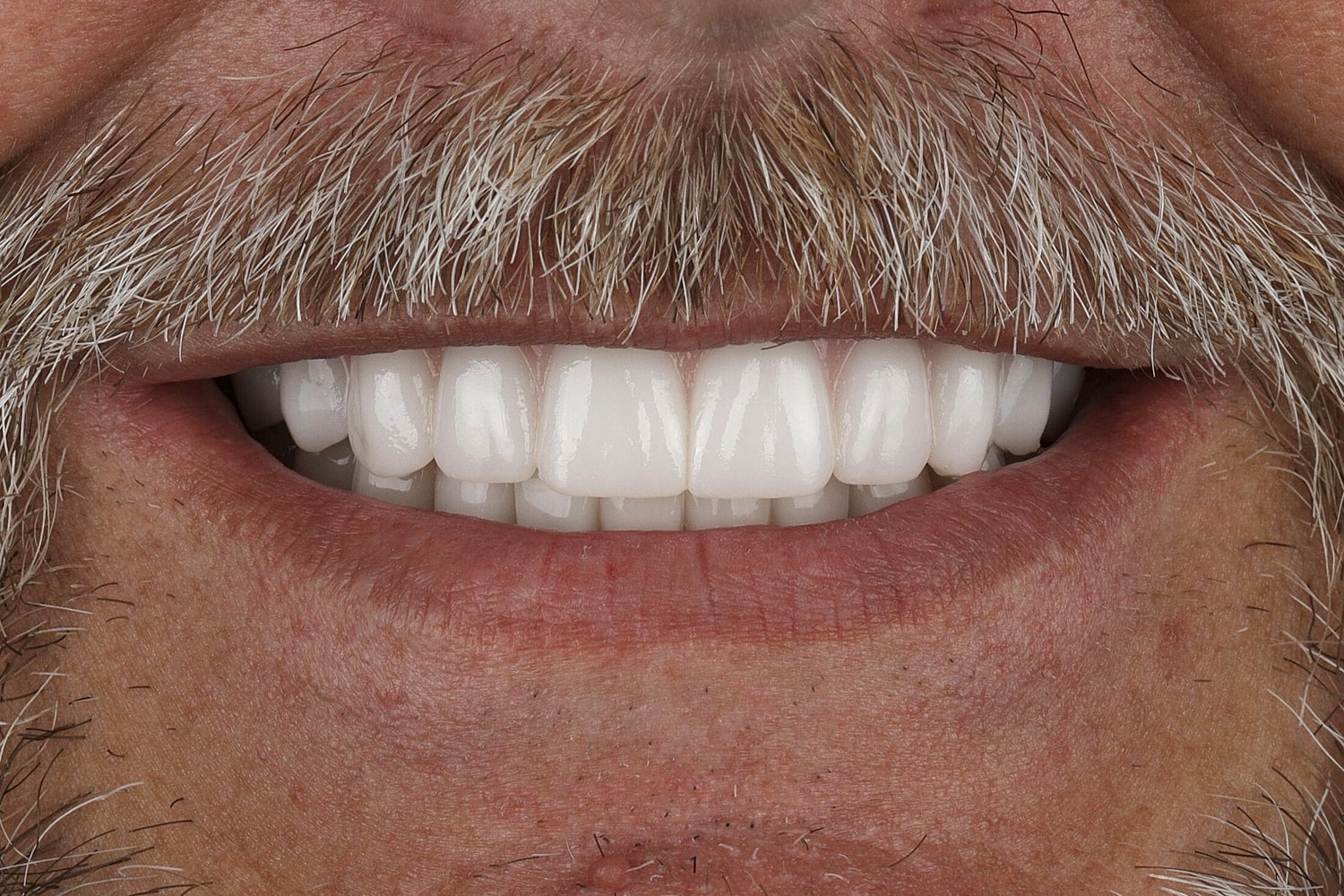 Patients Before & After