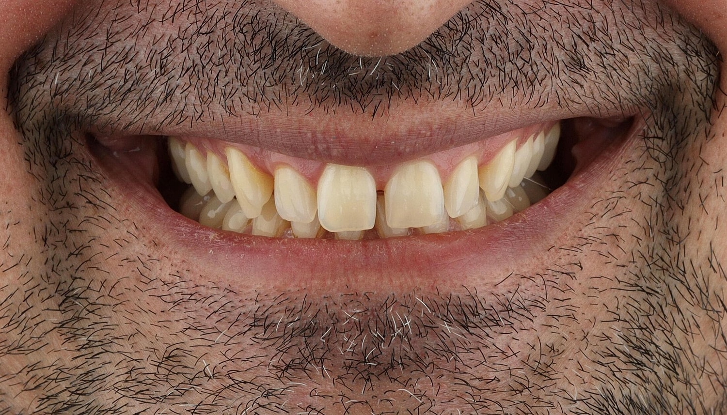 Patients Before & After
