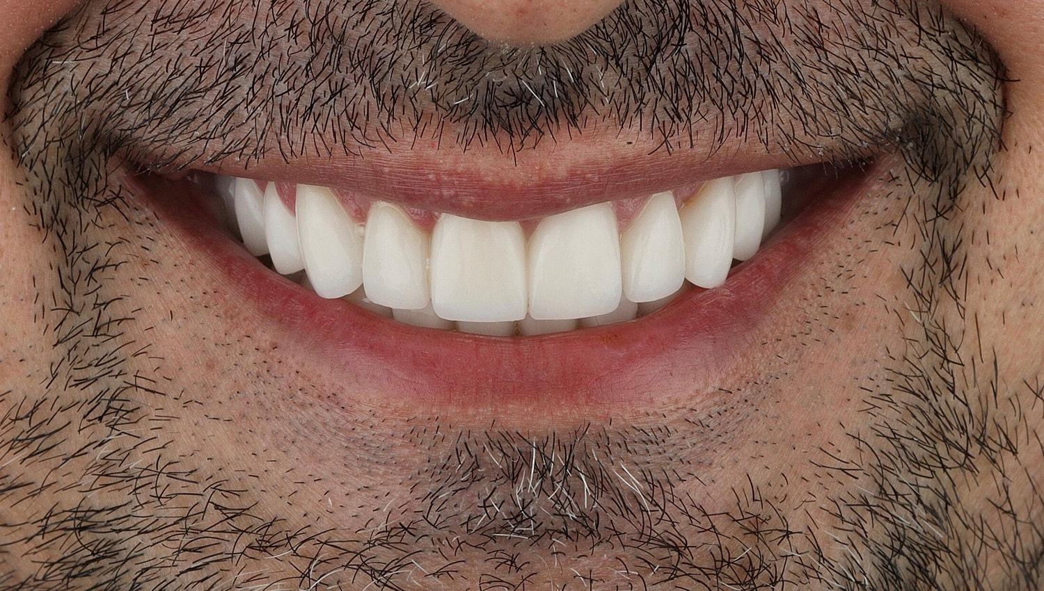 Patients Before & After