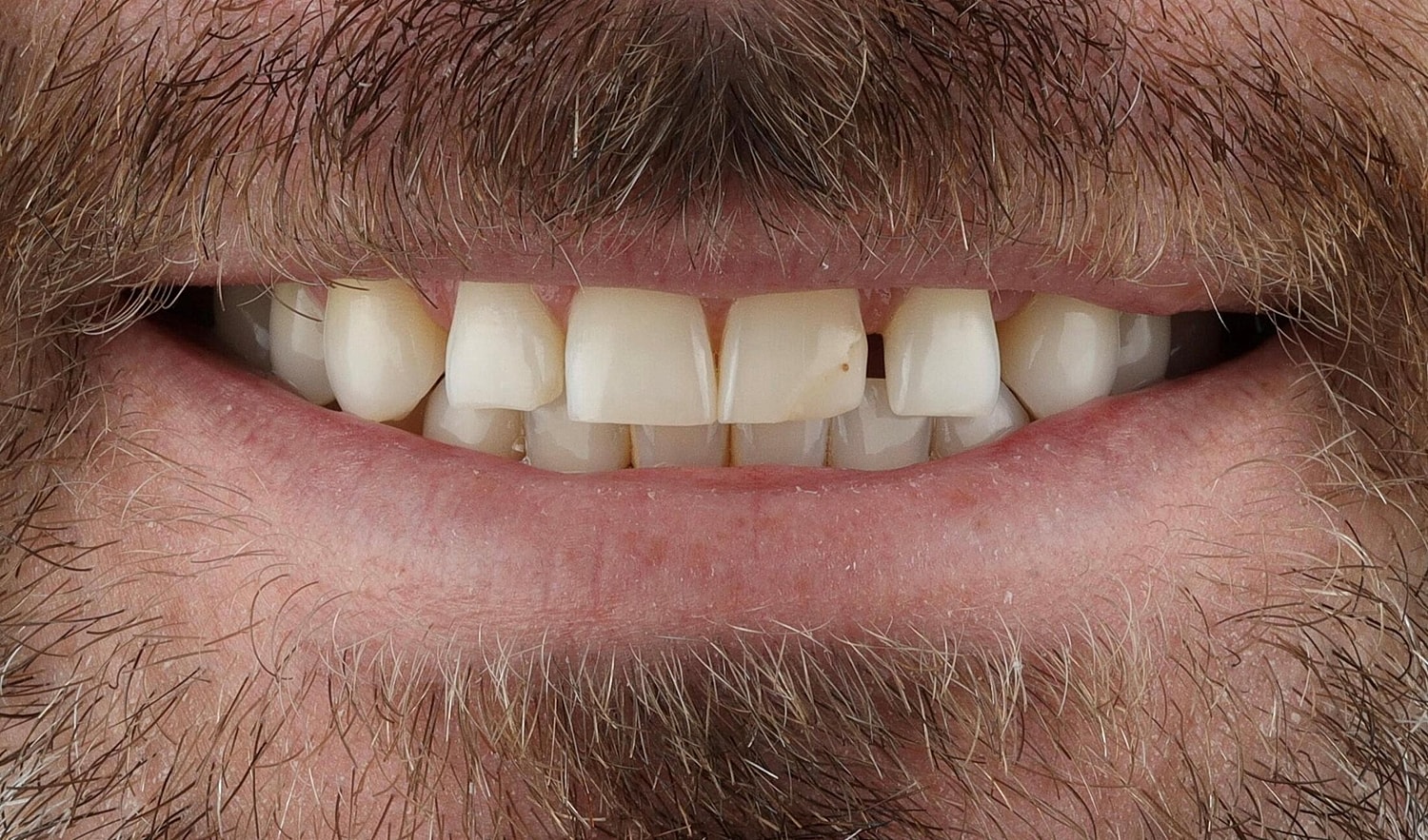 Patients Before & After