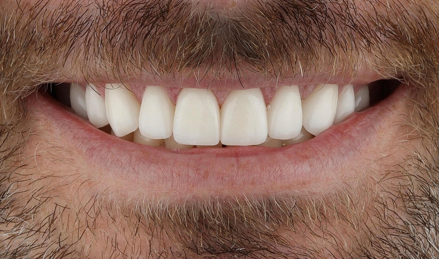 Patients Before & After