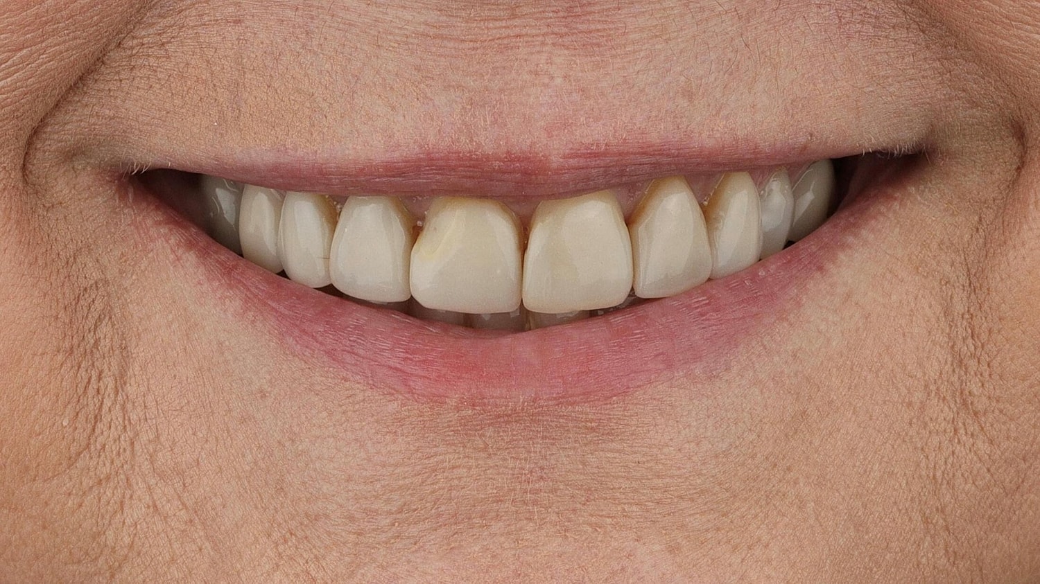 Patients Before & After