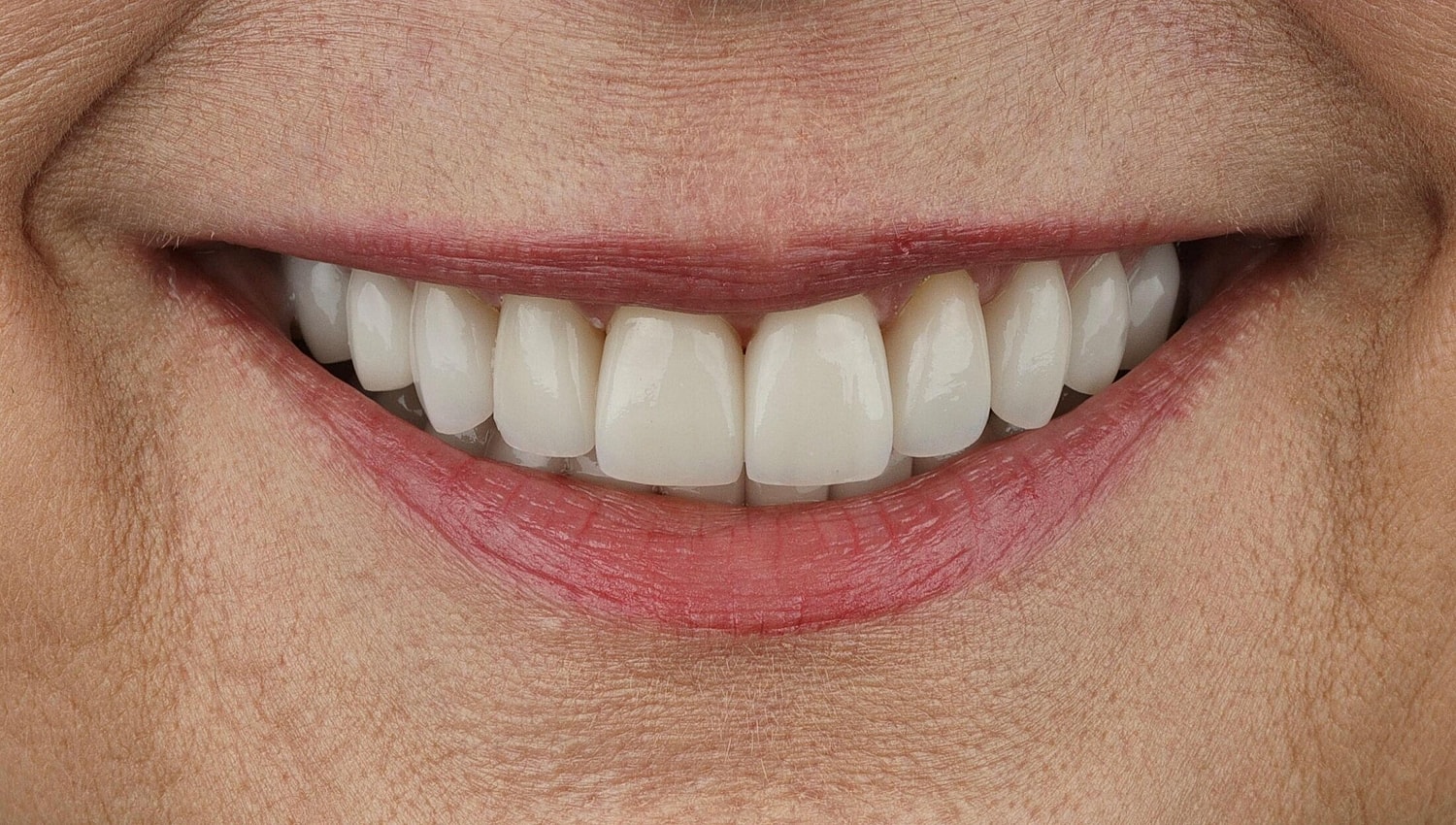 Patients Before & After