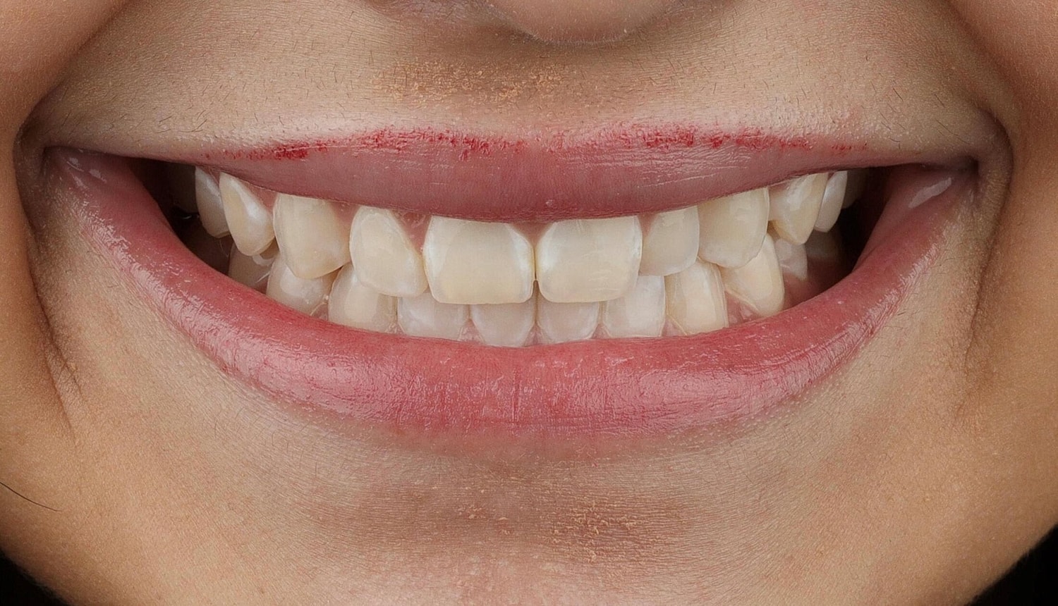 Patients Before & After