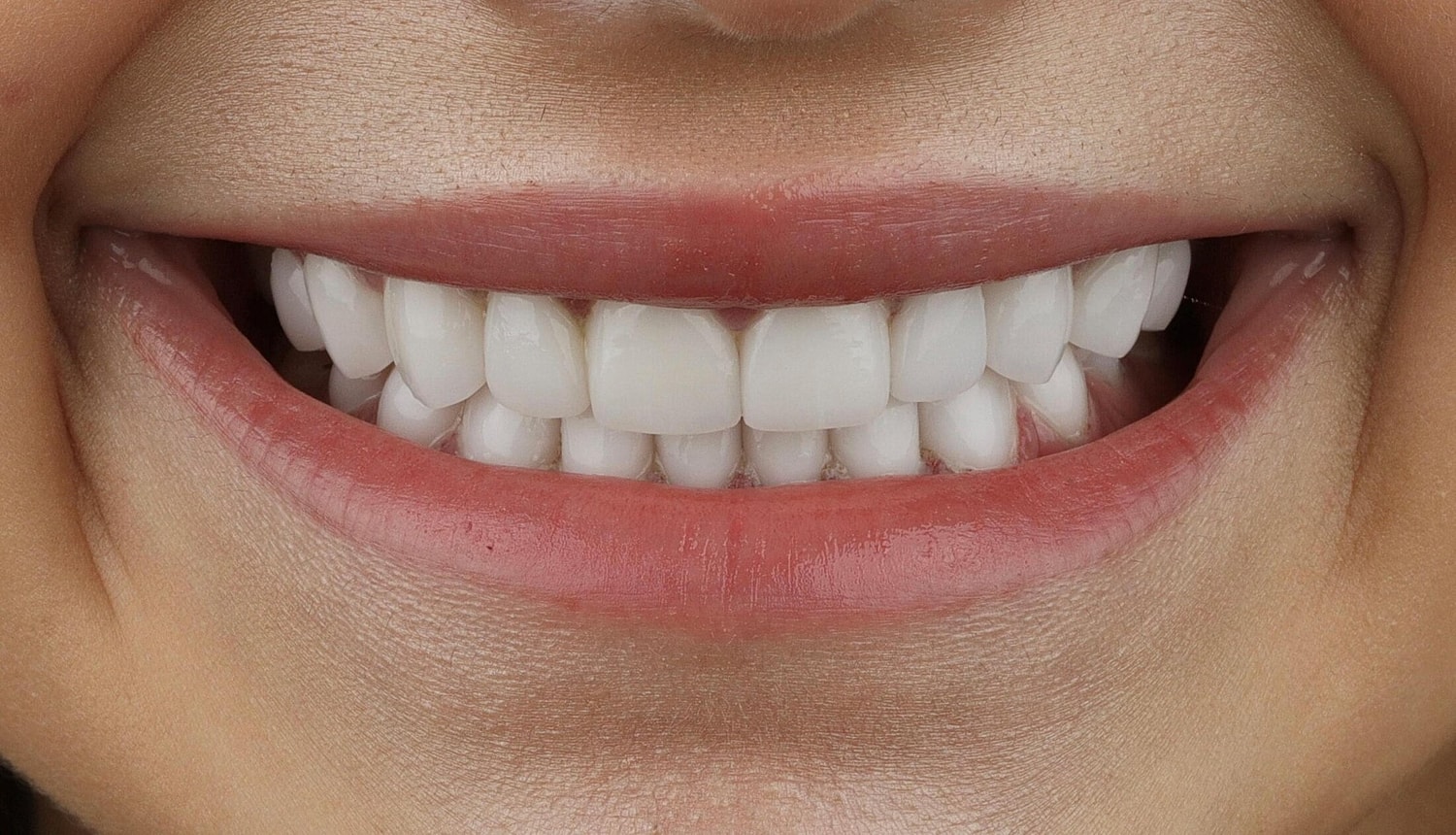 Patients Before & After