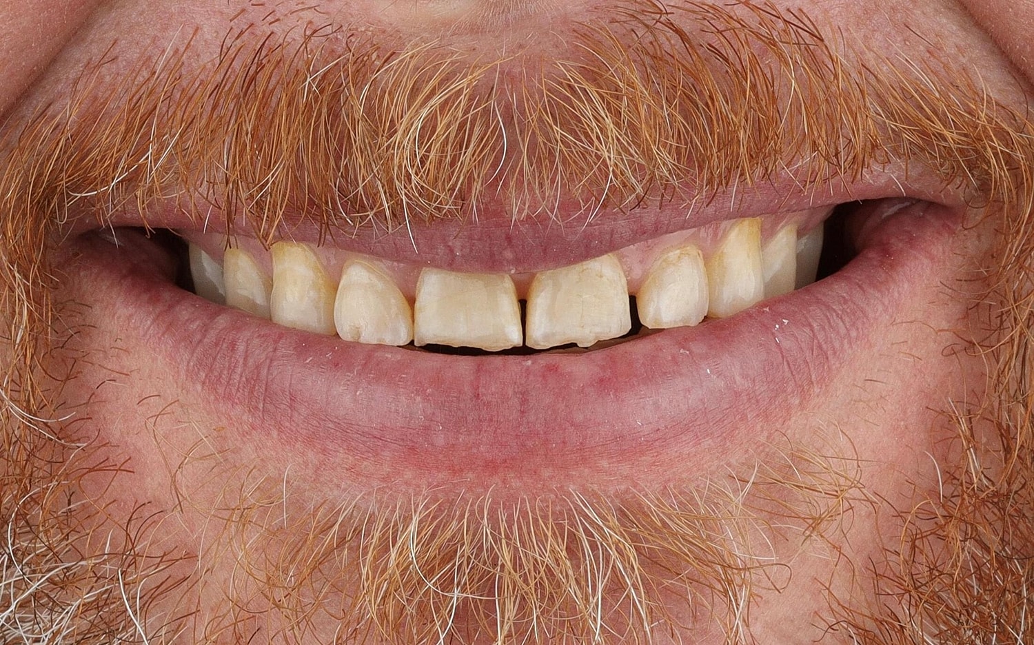 Patients Before & After