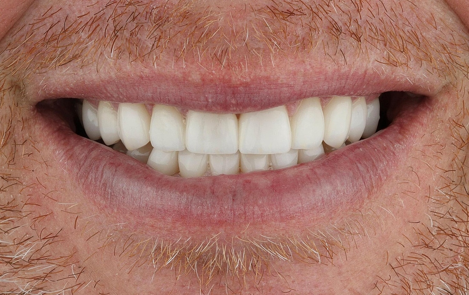 Patients Before & After