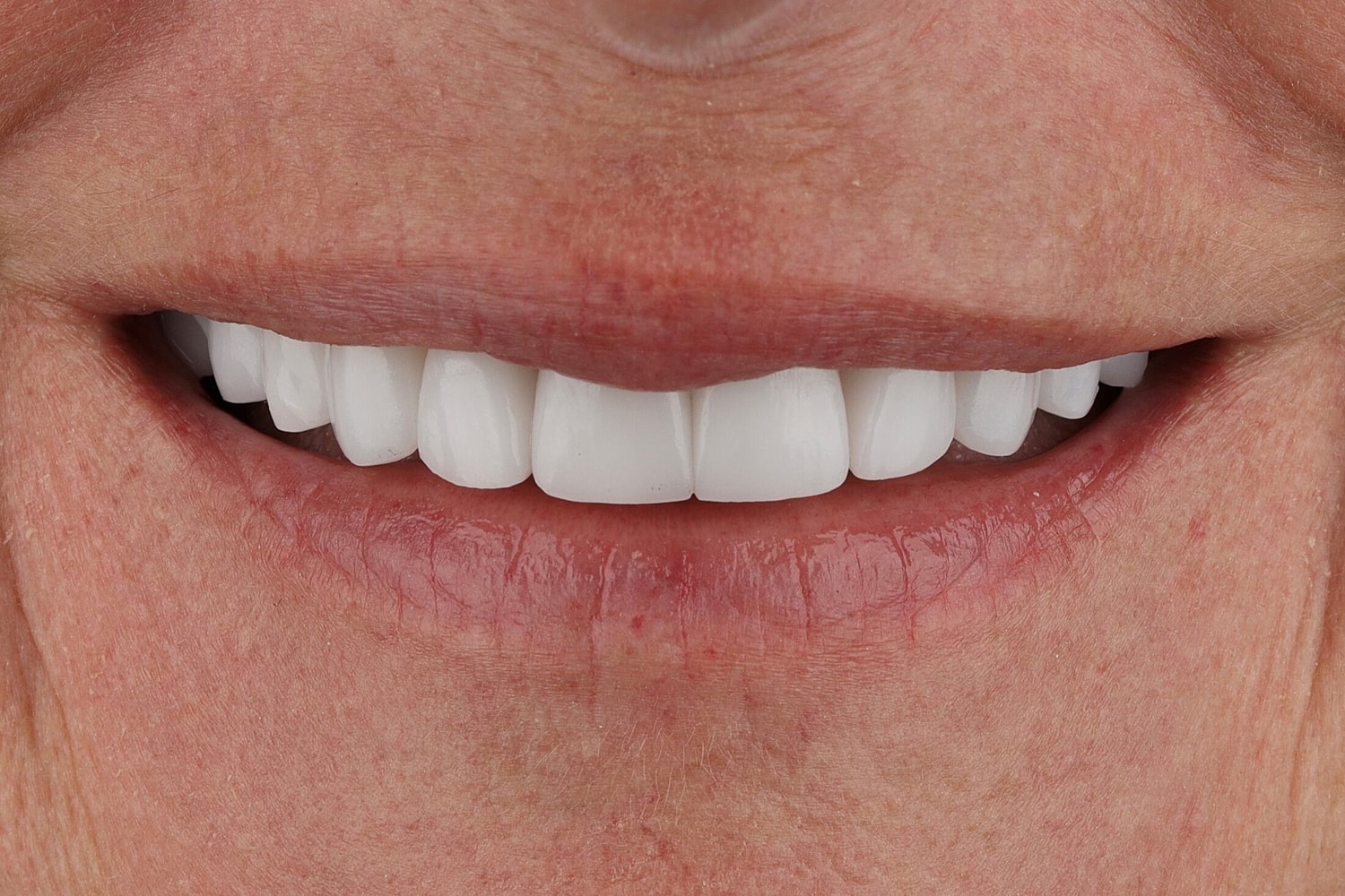Patients Before & After