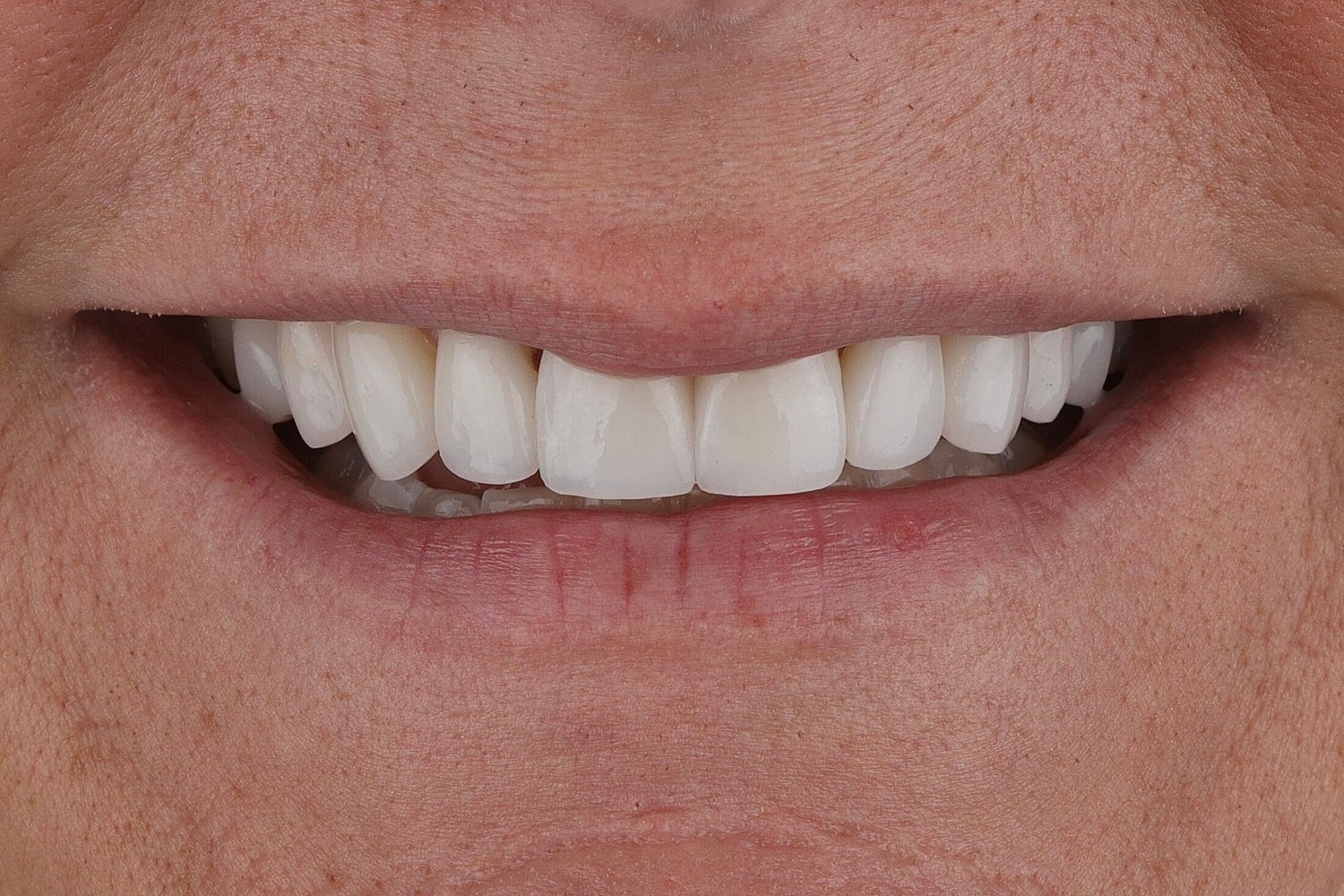 Patients Before & After