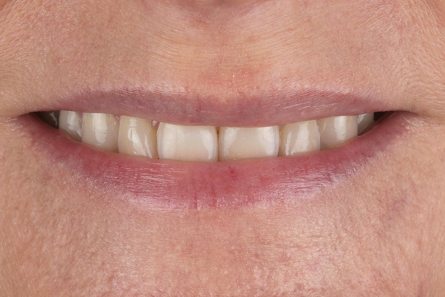 Patients Before & After