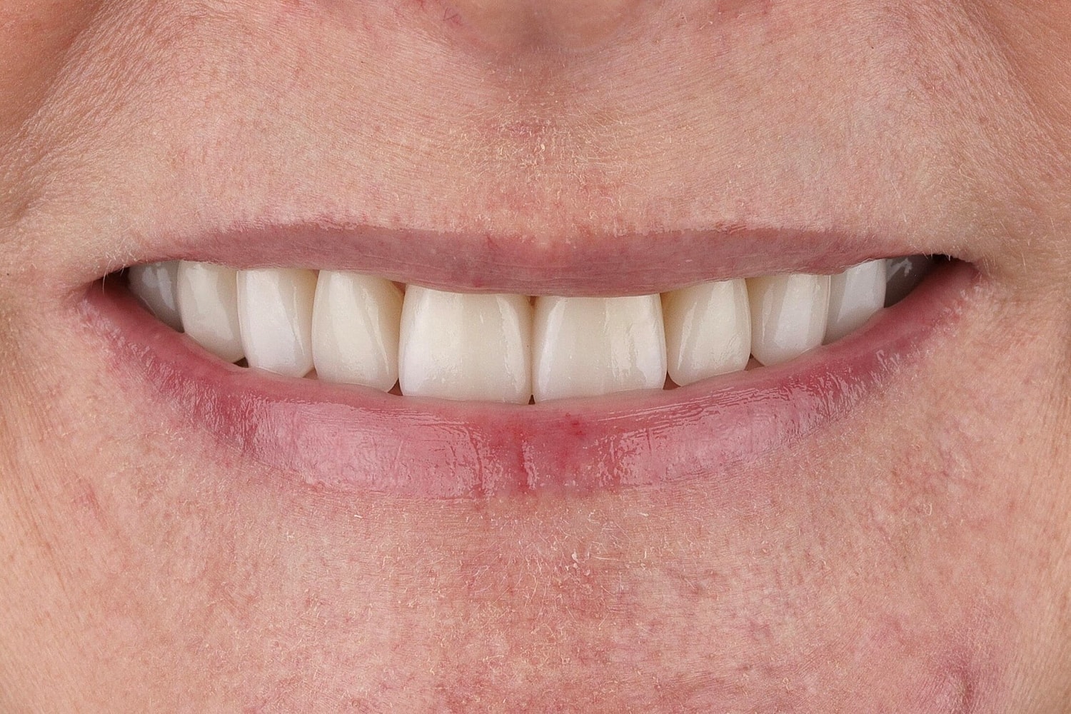 Patients Before & After