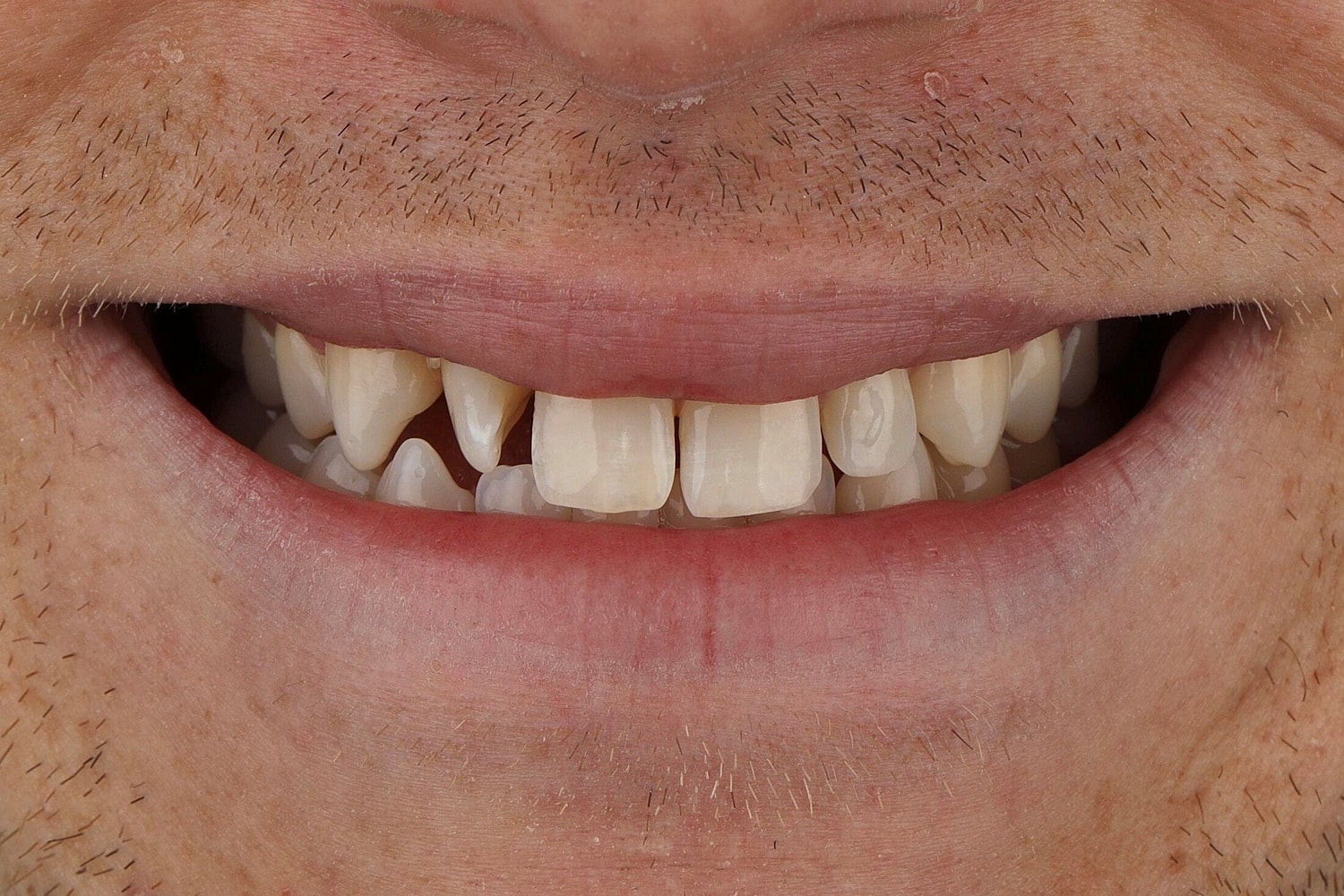 Patients Before & After