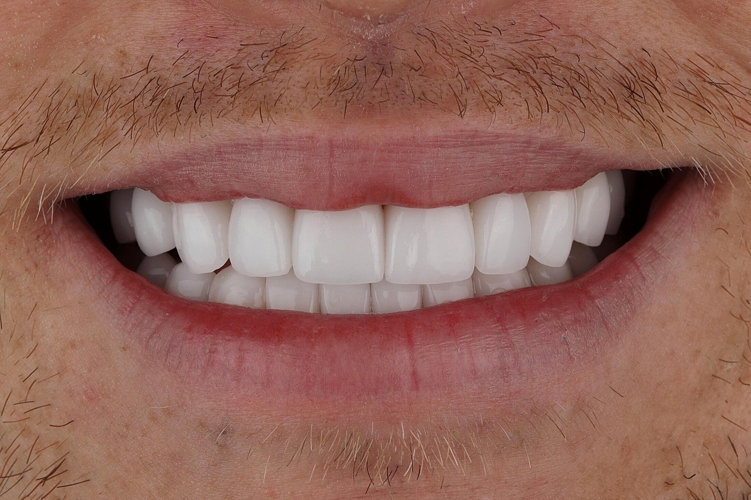 Patients Before & After