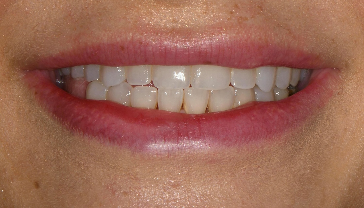 Patients Before & After