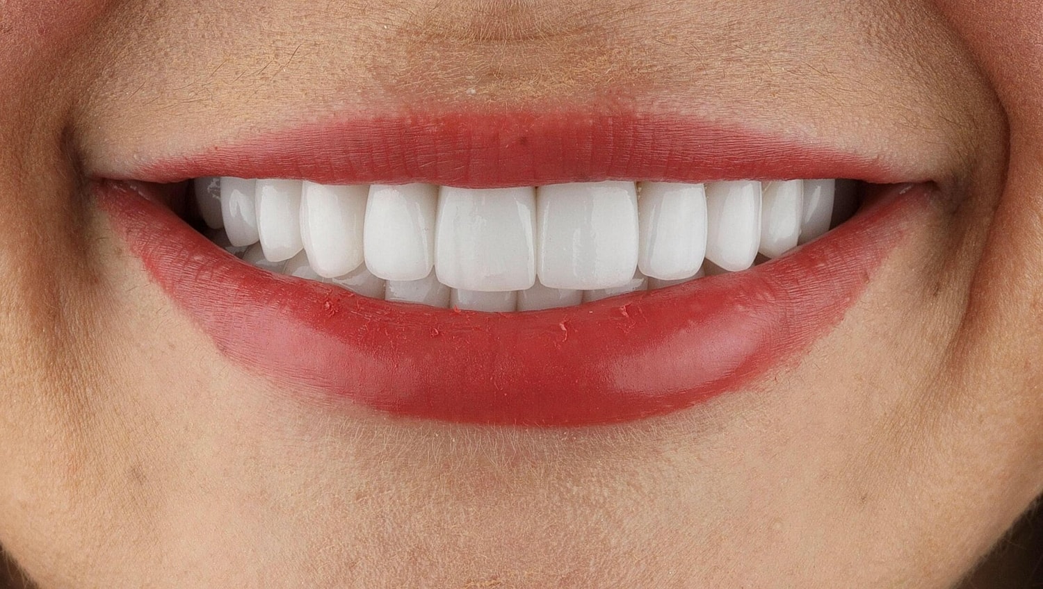Patients Before & After