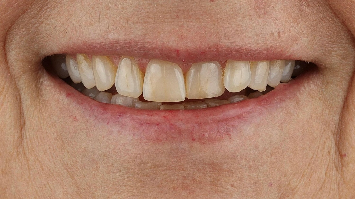 Patients Before & After