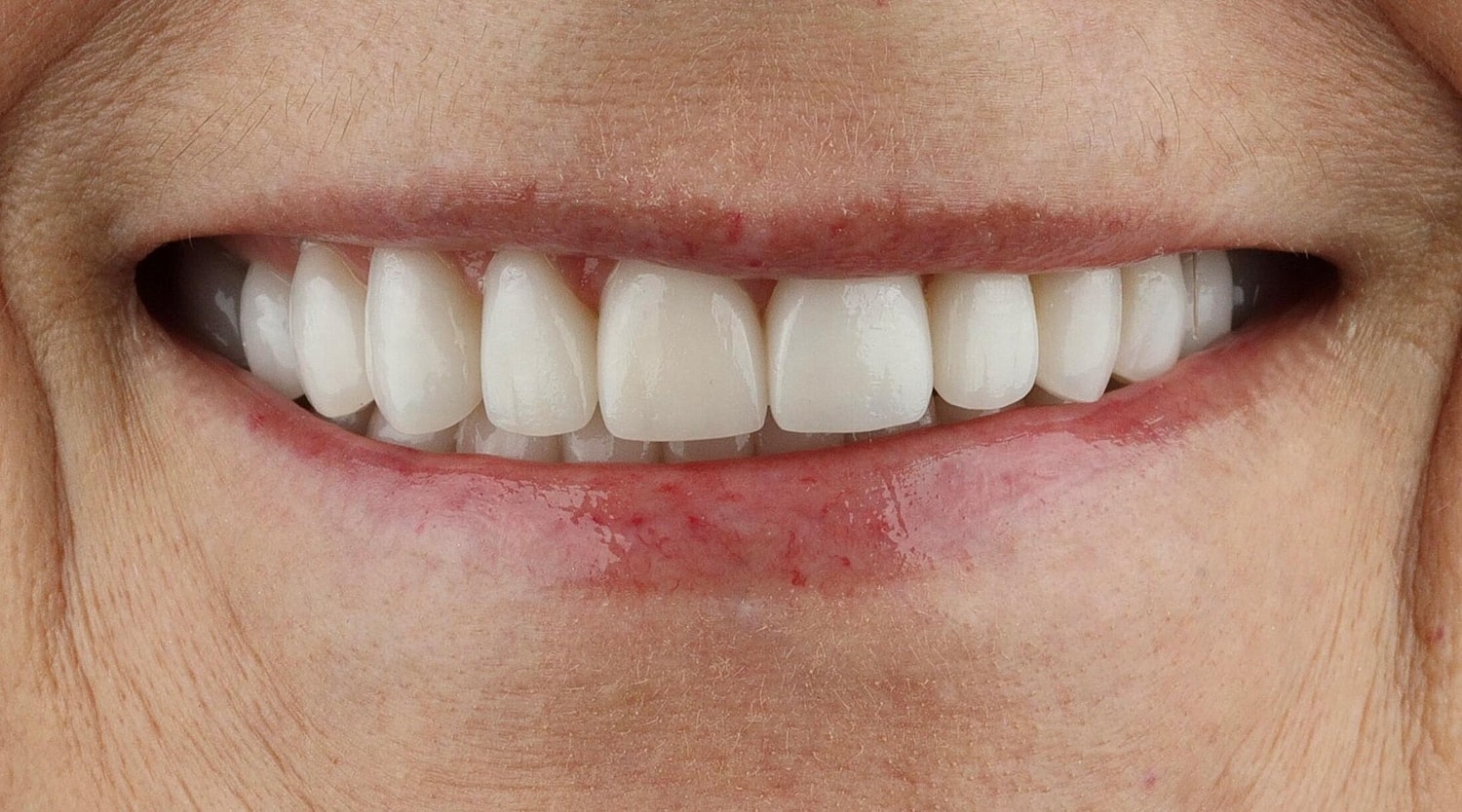 Patients Before & After