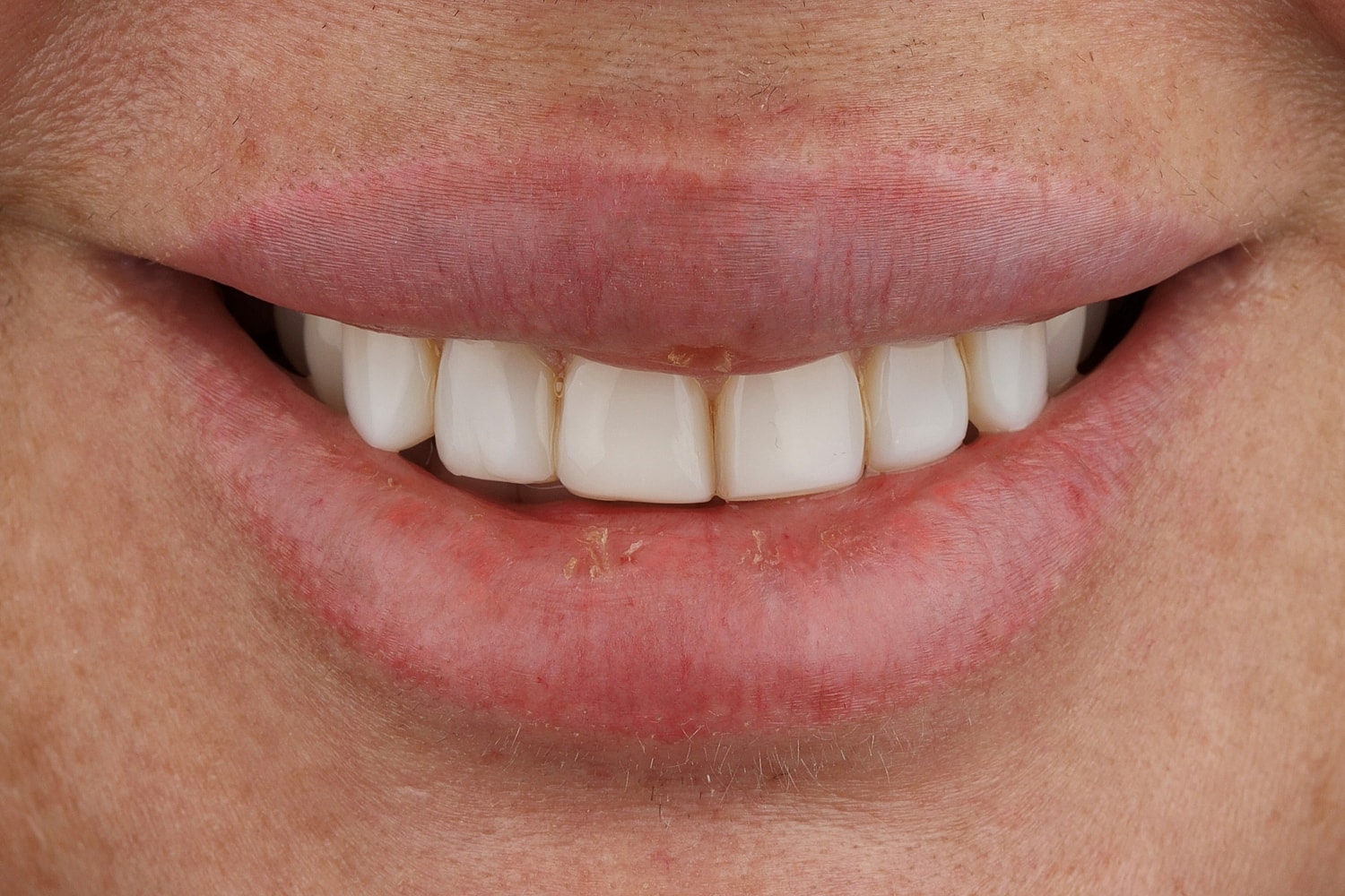 Close-up of a smiling mouth displaying teeth.