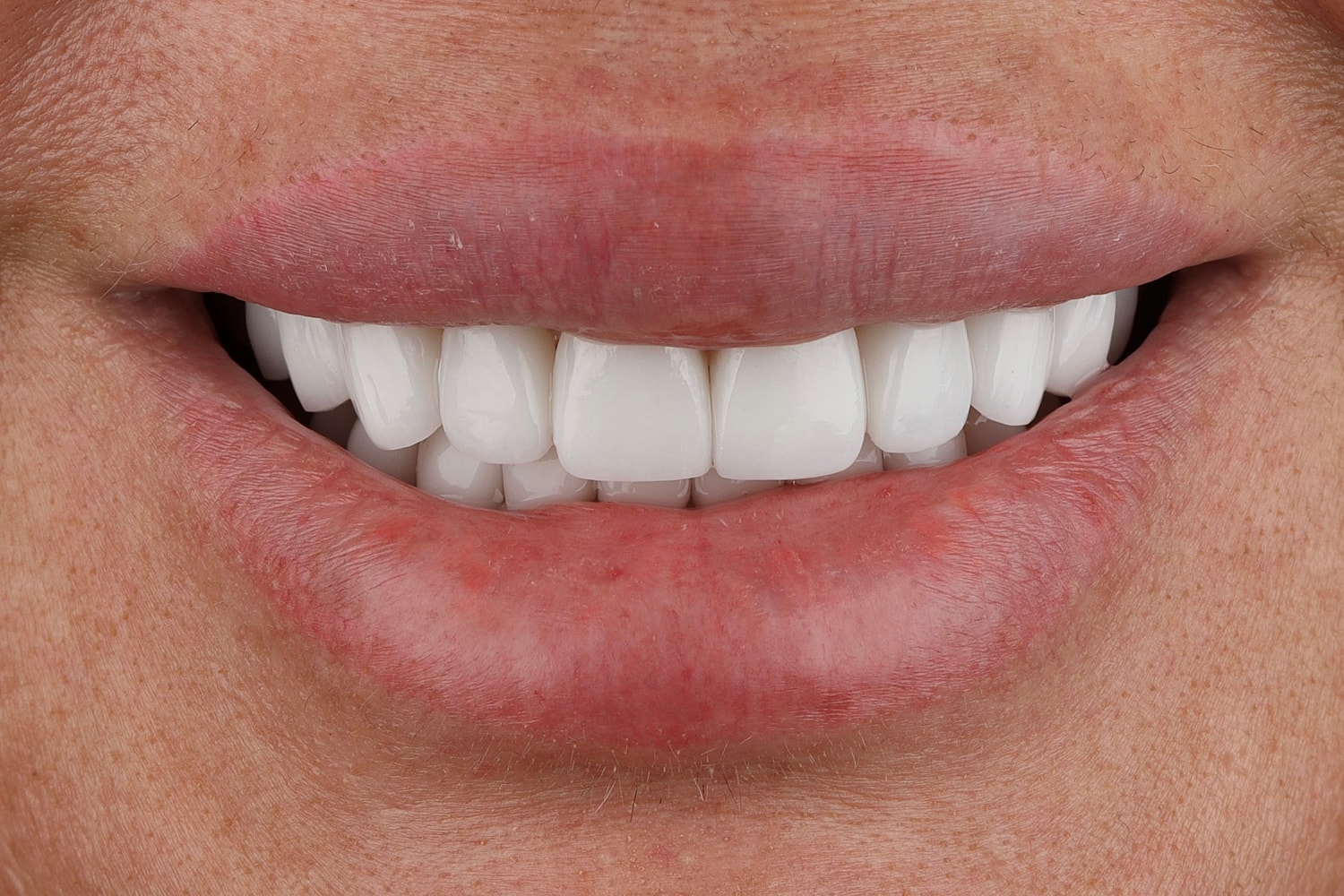 Close-up of a smiling mouth with white teeth.
