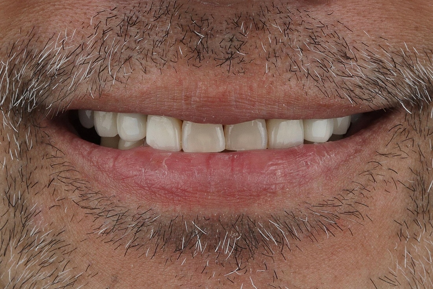 Patients Before & After