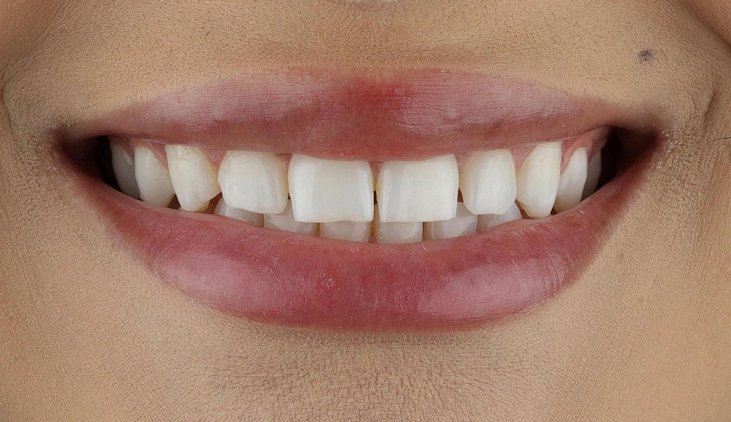 Patients Before & After
