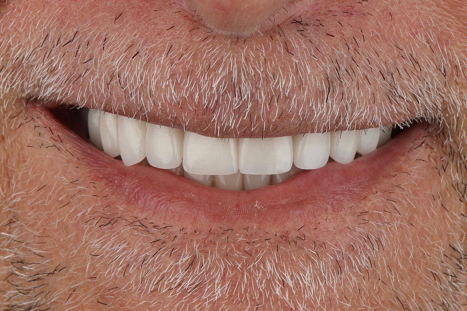 Patients Before & After
