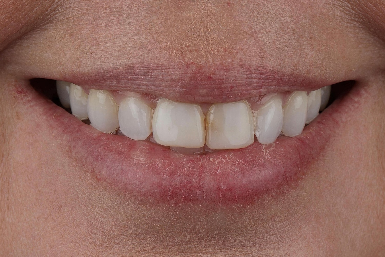 Patients Before & After