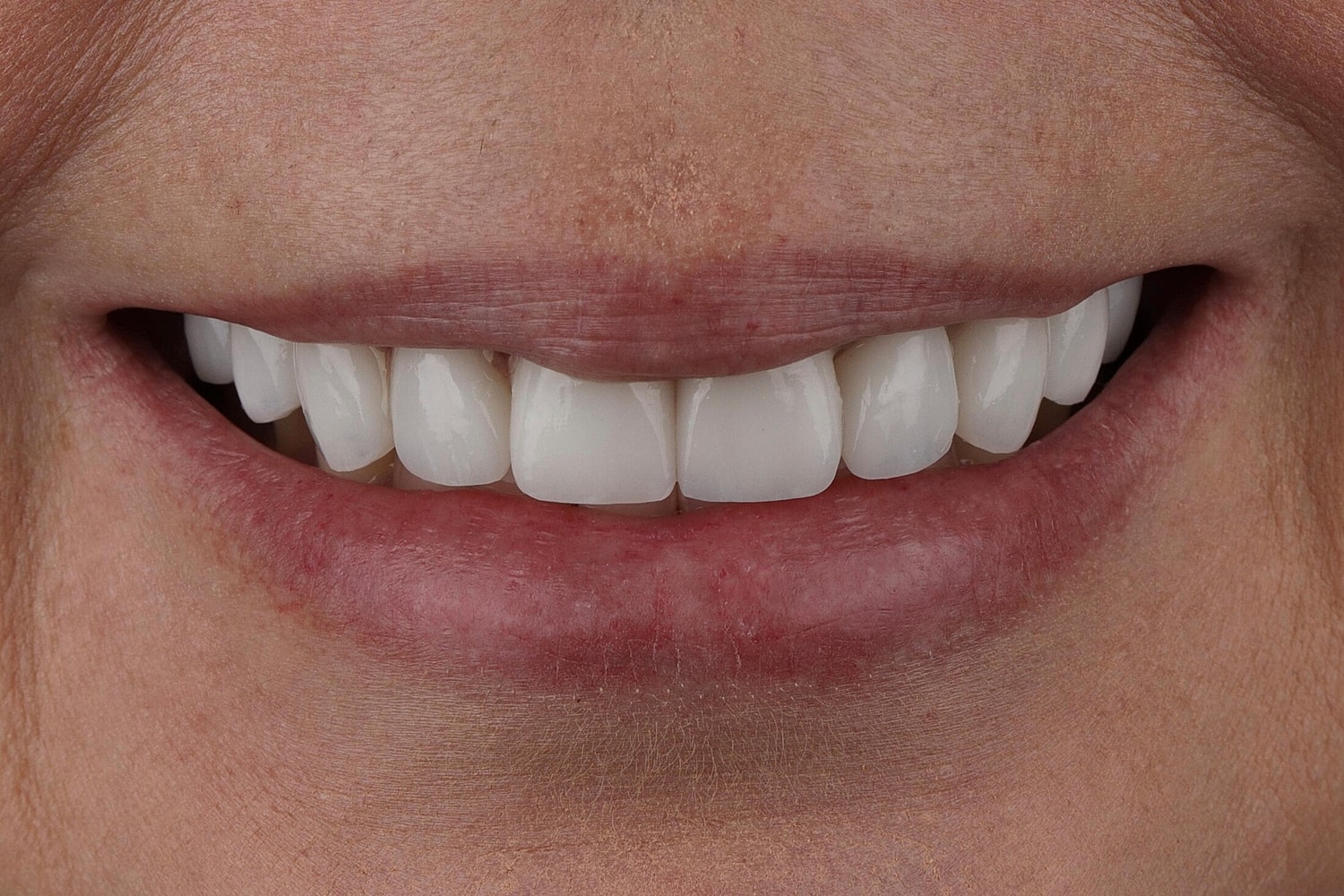Patients Before & After