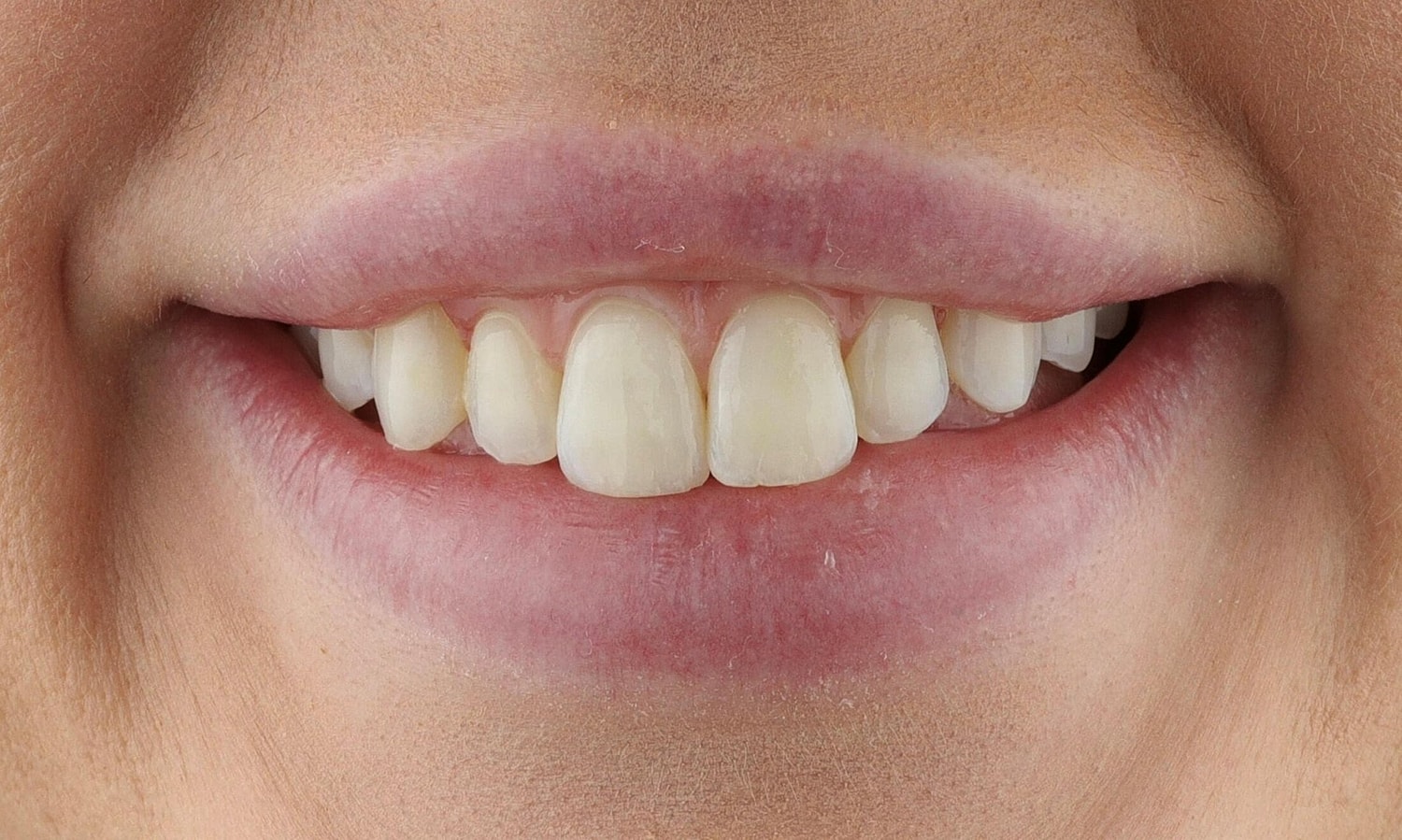 Patients Before & After