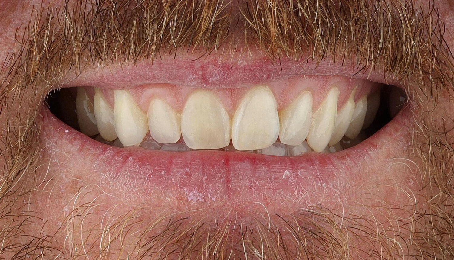 Patients Before & After