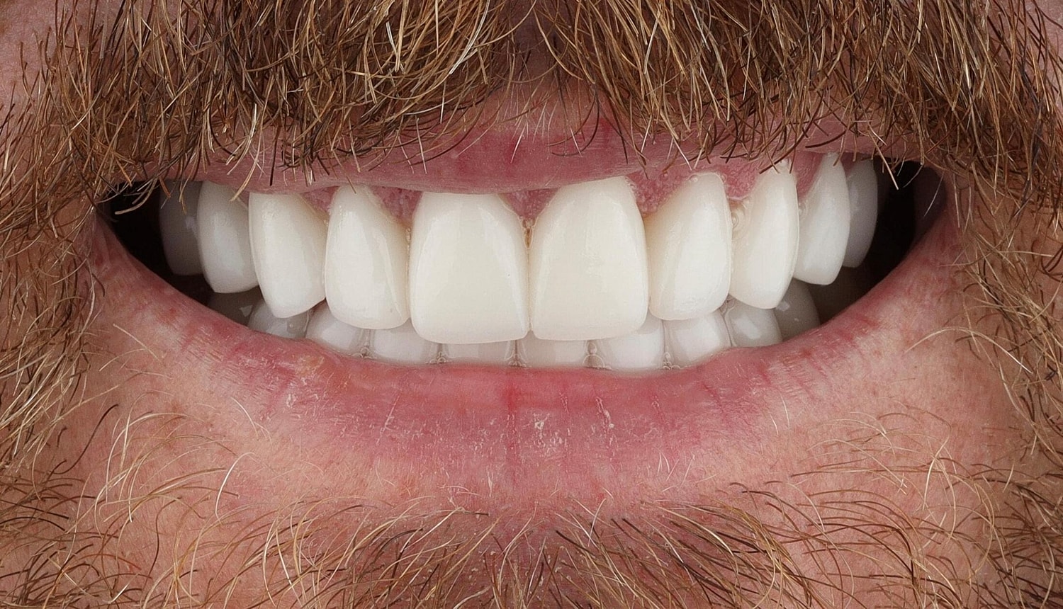 Patients Before & After