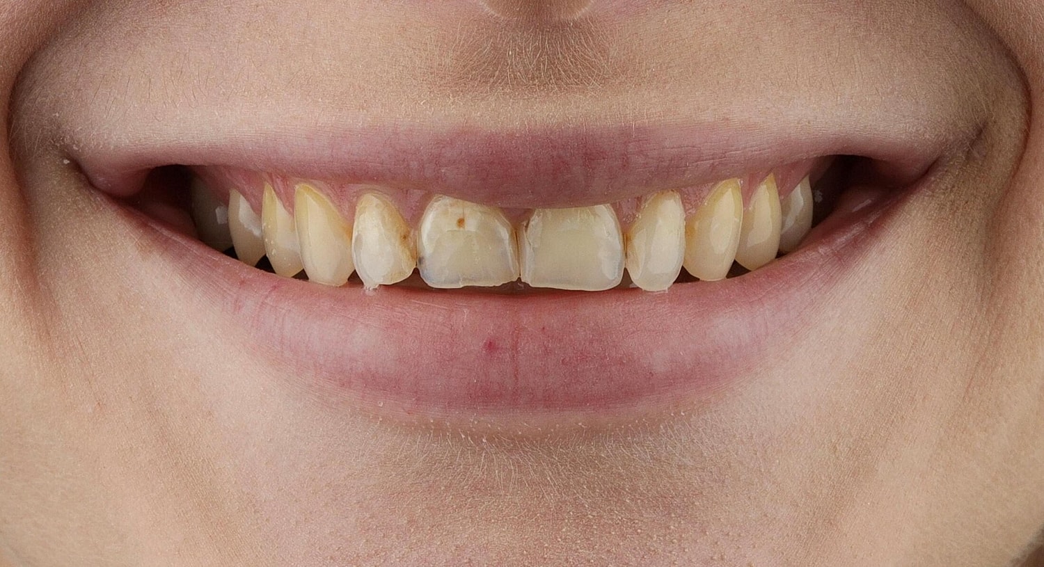Patients Before & After