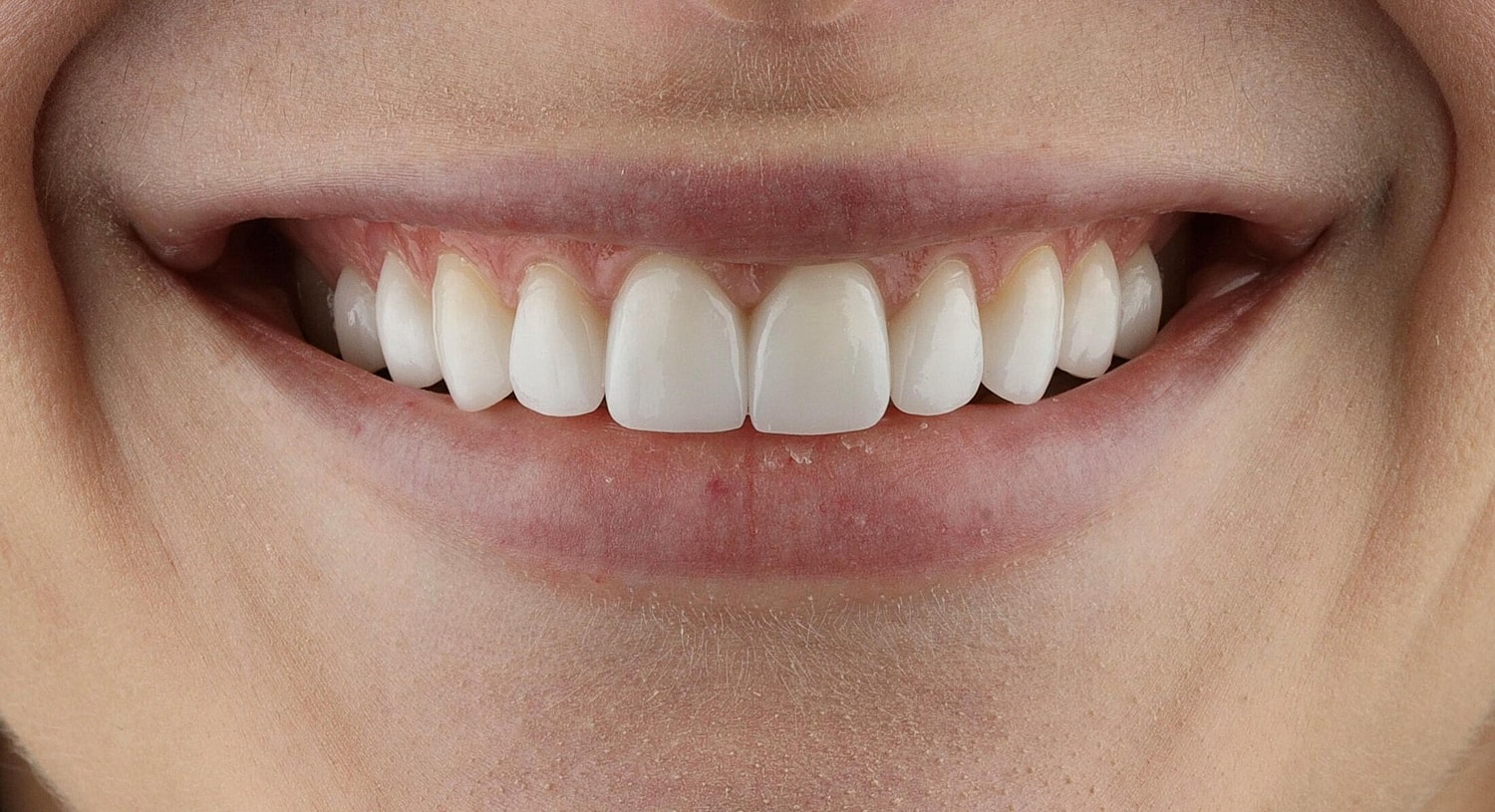Patients Before & After