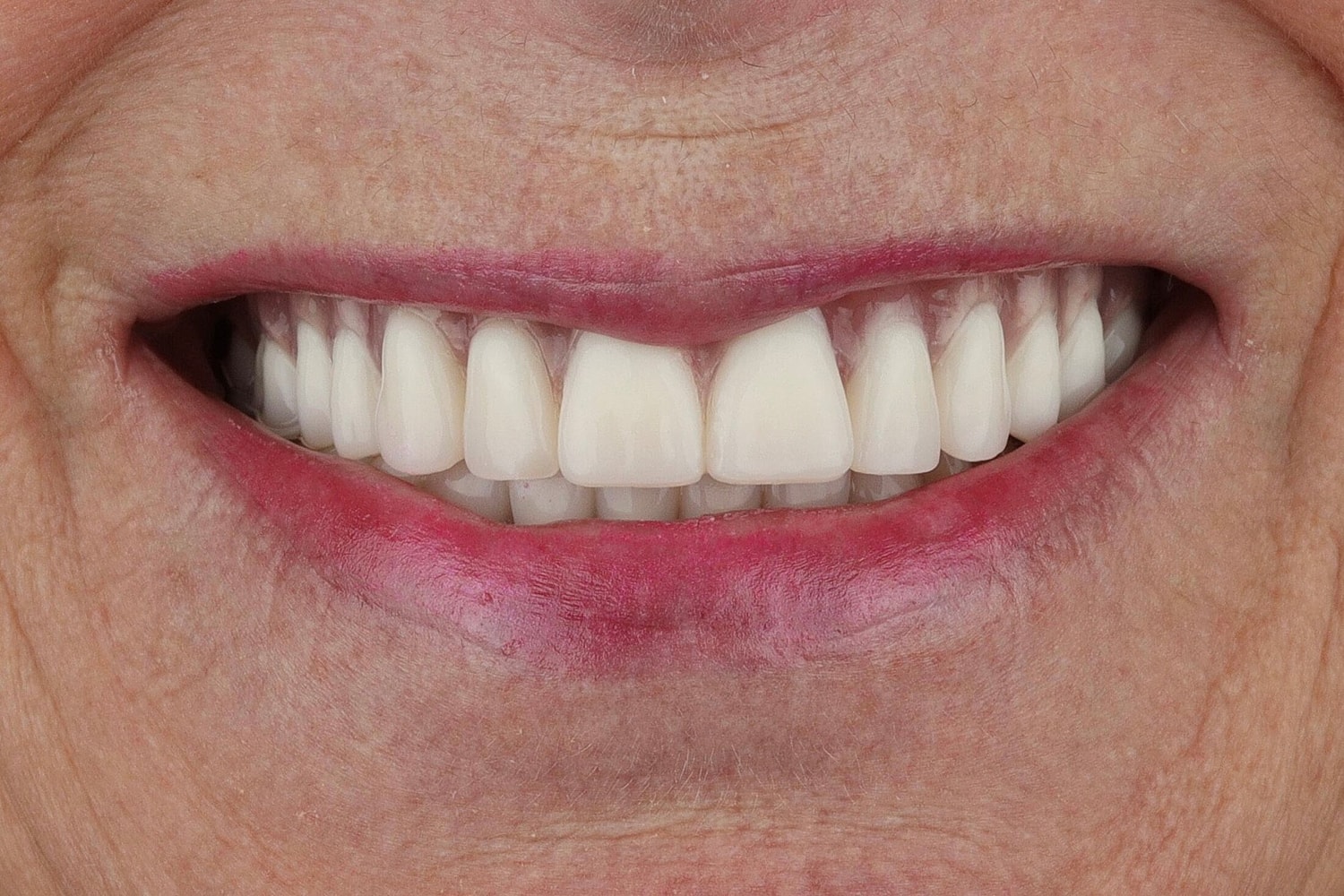 Patients Before & After