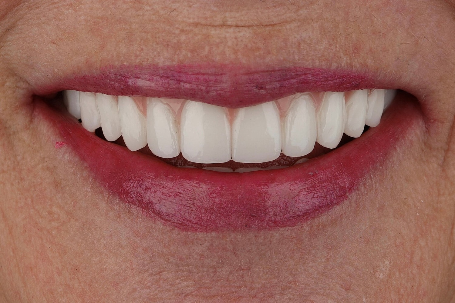 Patients Before & After