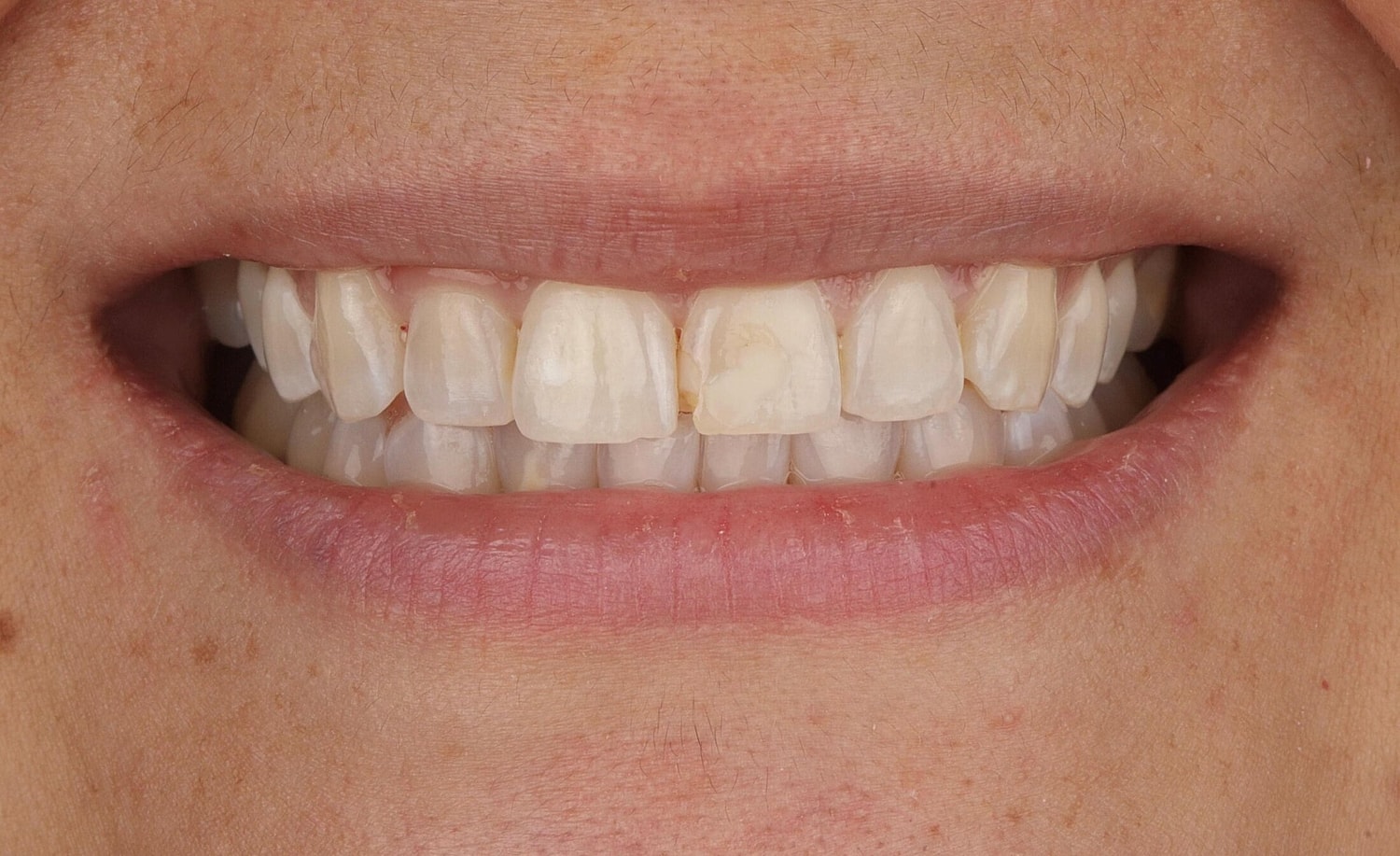Patients Before & After